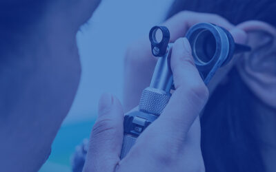What level of hearing loss requires a hearing aid?